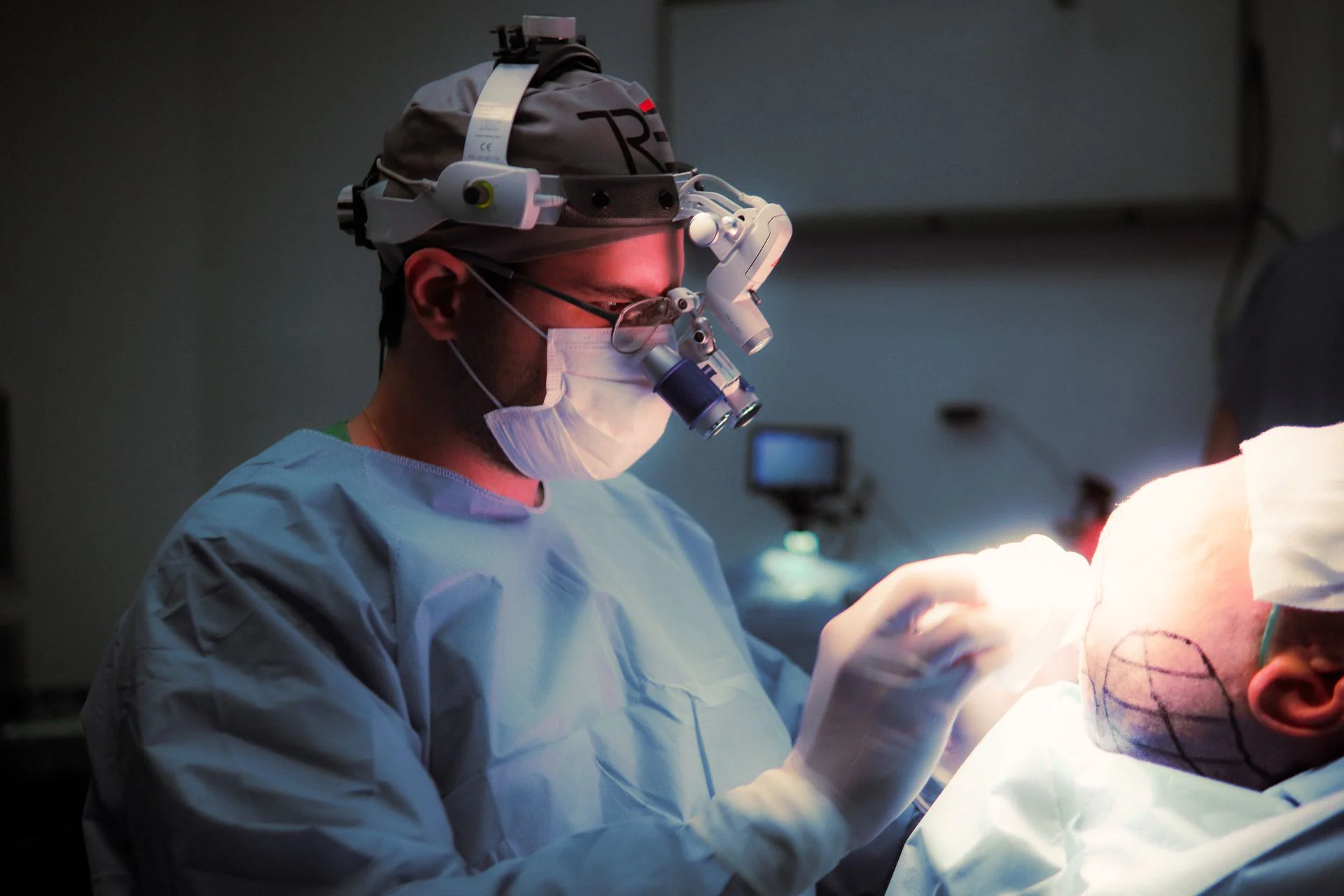 un médico realizando una reparación de injerto capilar